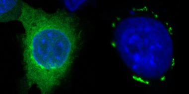 Helmholtz Munich: Neuer Ansatz in der Krebstherapie - mit innovativem Mechanismus zur Induktion von Ferroptose